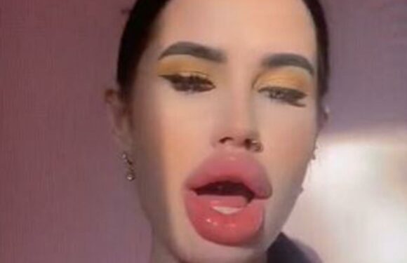 I'm unrecognisable after having lip fillers – Trolls call me a bimbo but I don't care, I want them to be the biggest | The Sun