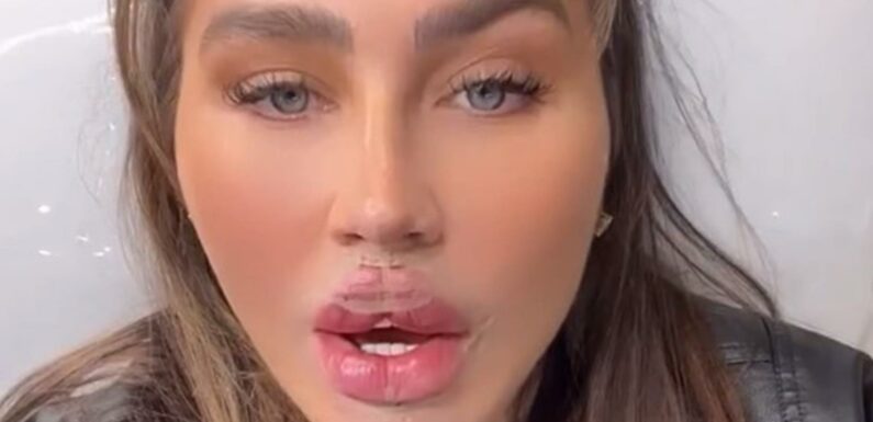Lauren Goodger reveals new face as she gets huge 'butterfly lips' | The Sun