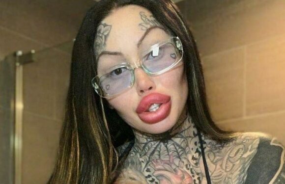 Model with ‘world’s fattest vagina’ sick of surgery after 38J implants explode
