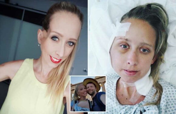 Mum left with huge dent in her head after partner spotted 'something different' about her | The Sun