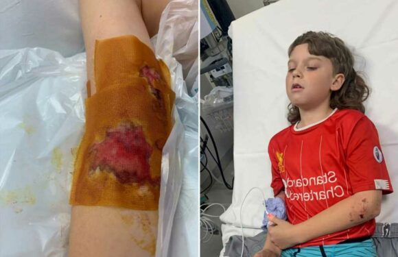 My son, 10, was savaged by out-of-control dog while playing football | The Sun