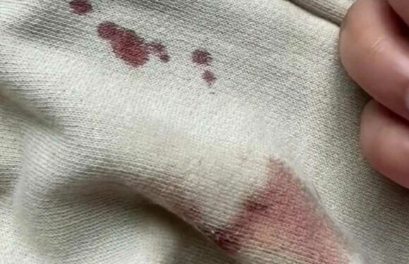People are only just realising how to get rid of blood stains on clothes & it's totally free | The Sun
