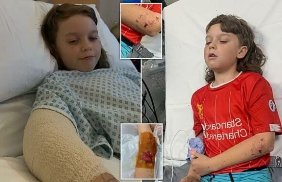 Schoolboy, 10, has skin torn off after being mauled by 'terrier dog'