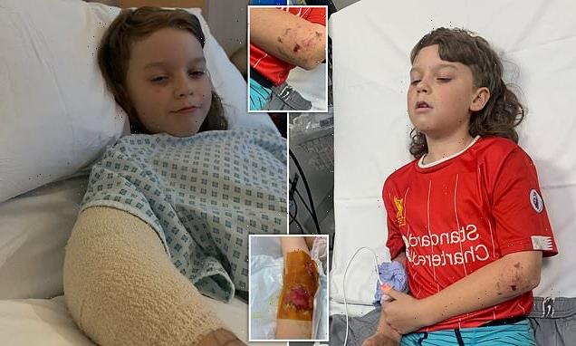 Schoolboy, 10, has skin torn off after being mauled by 'terrier dog'