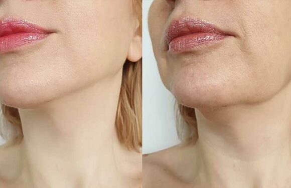 Shoppers Say This ‘Instant’ Lifting Cream Actually Does Work That Fast