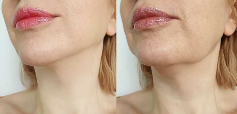 Shoppers Say This ‘Instant’ Lifting Cream Actually Does Work That Fast