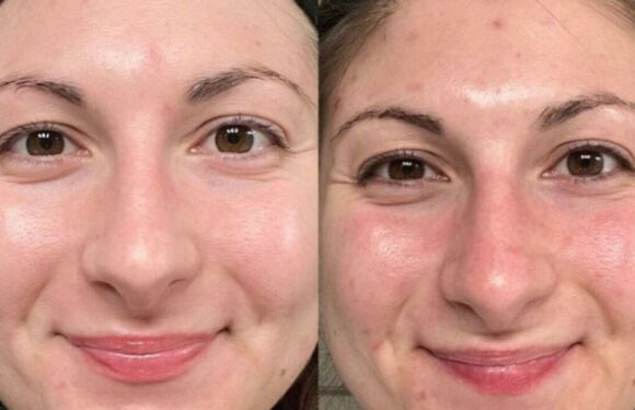 Shoppers rave over anti-ageing toner that leave skin ‘soft and dewy’