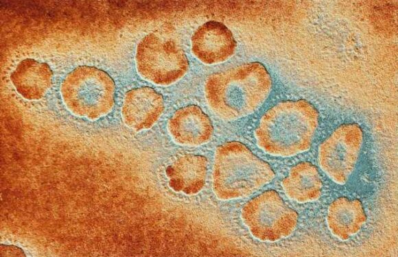 'Worst-case bird flu scenarios’ being probed by top Covid scientists after girl, 11, dies | The Sun