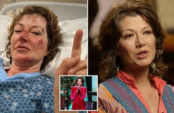 Amy Grant reveals severe brain trauma made her forget her own songs