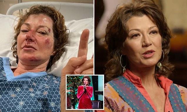 Amy Grant reveals severe brain trauma made her forget her own songs