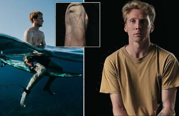 Aussie shark attack survivor's incredible road to recovery