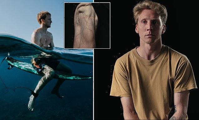 Aussie shark attack survivor's incredible road to recovery