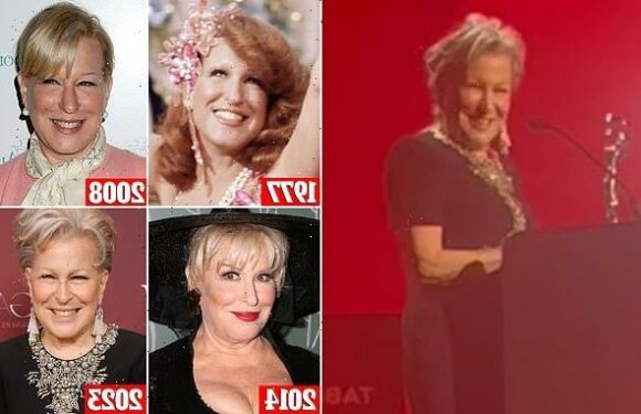 Bette Midler, 77, admits she's undergone cosmetic work on her face