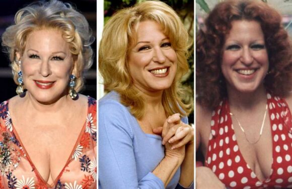 Bette Midler, 77, finally admits shes had some tailoring done to her face