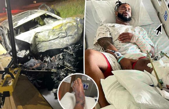 Challenge star Nelson Thomas shares gruesome photos of car accident injuries