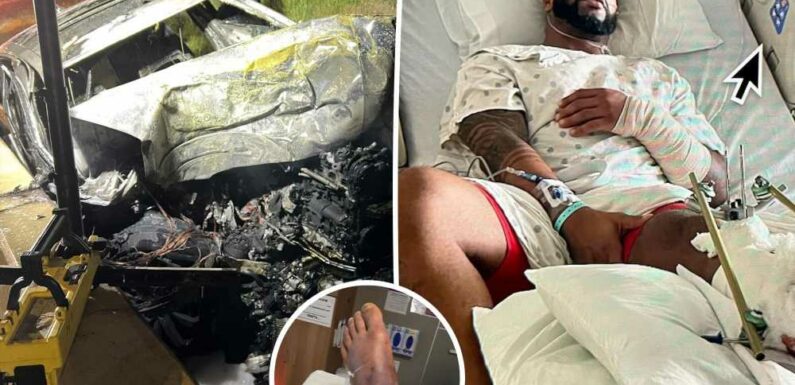 Challenge star Nelson Thomas shares gruesome photos of car accident injuries