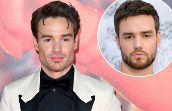 Cosmetic surgery experts weigh in on Liam Paynes shocking new look