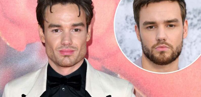 Cosmetic surgery experts weigh in on Liam Paynes shocking new look
