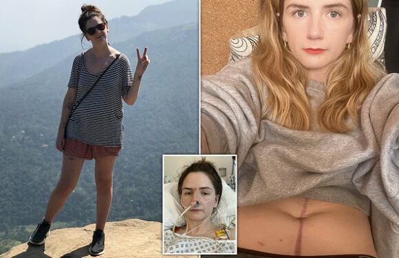Doctors tried FIVE times to remove my contraceptive coil