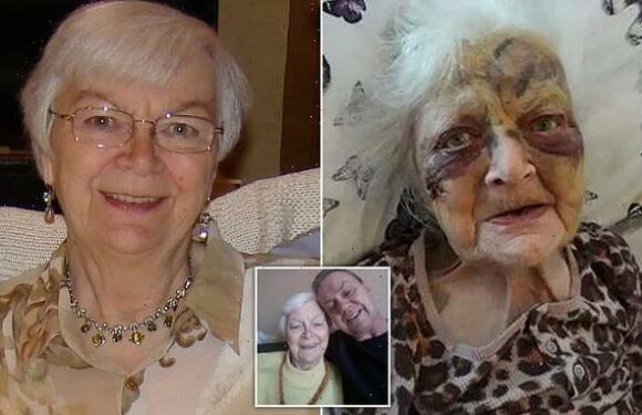 Great-grandmother left with facial injuries after care home incident