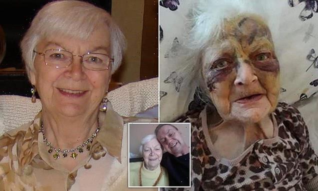 Great-grandmother left with facial injuries after care home incident
