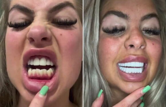 I got Turkey teeth & love them…trolls say they’re brighter than most people’s futures & I should have got braces instead | The Sun