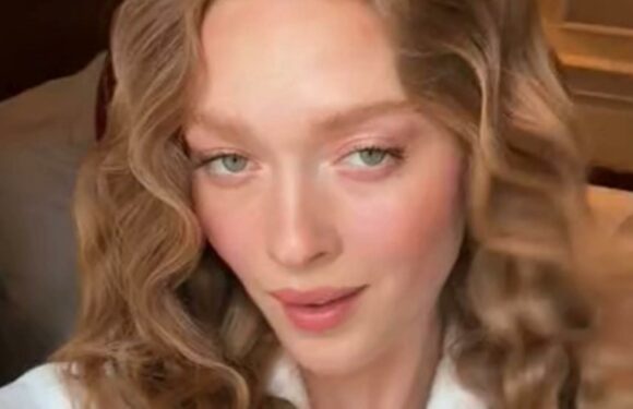 I’m a redheaded model – there’s a spicy term I hate and people always ask if they can count my freckles | The Sun