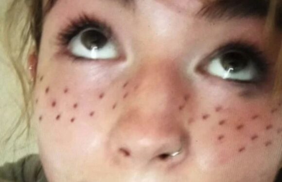 I'm a tattooist & my client came to me to fix a shocking freckle tat – but not everyone's convinced on the finished look | The Sun