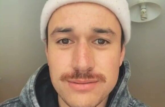 I'm never seen without a beanie because I'm a true hatfish – people say I should shave my head it's that bad | The Sun