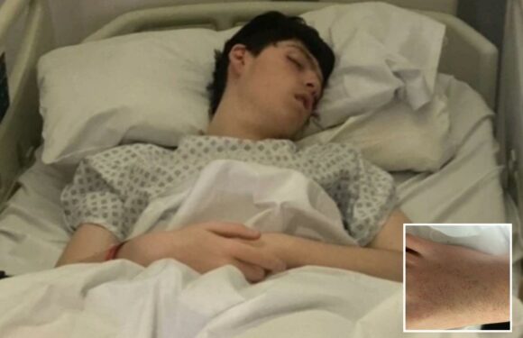 I'm sharing heartbreaking images of my son after a rash left him fighting for his life | The Sun