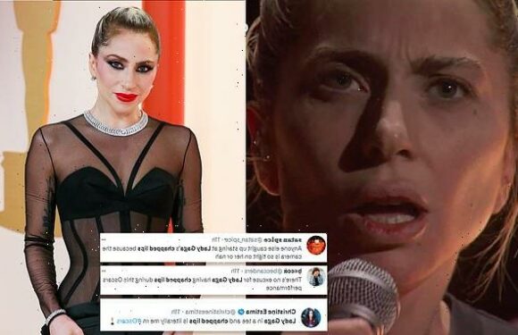Lady Gaga's chapped lips go viral after her Oscars performance