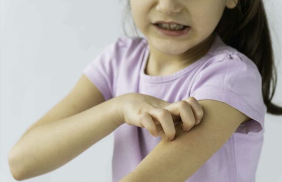Major change to kids' treatment for eczema on the NHS – as free therapy 'ditched' | The Sun