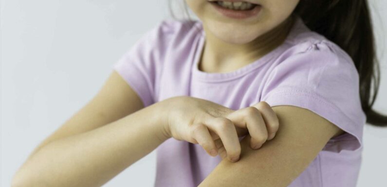 Major change to kids' treatment for eczema on the NHS – as free therapy 'ditched' | The Sun