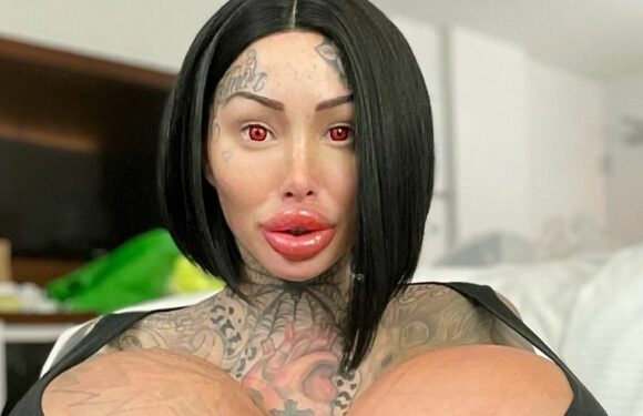 Model whose 38J implant exploded spent £30k to fix chest and get boobs smaller