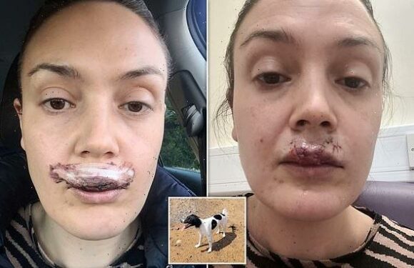 Mother left with no feeling in her top lip after attack by her own dog