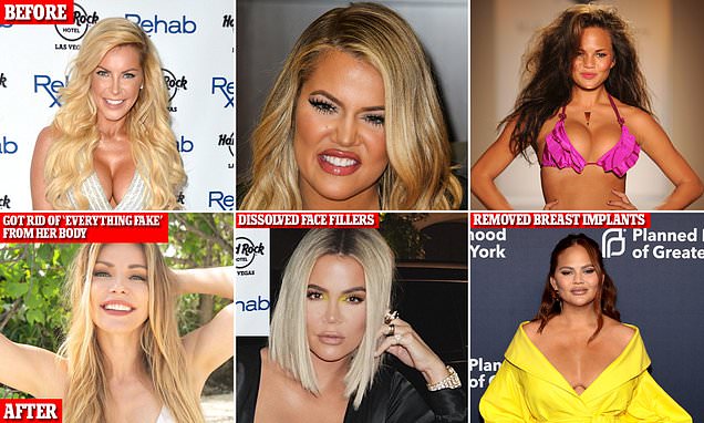 The celebrities who have U-turned on their cosmetic procedures