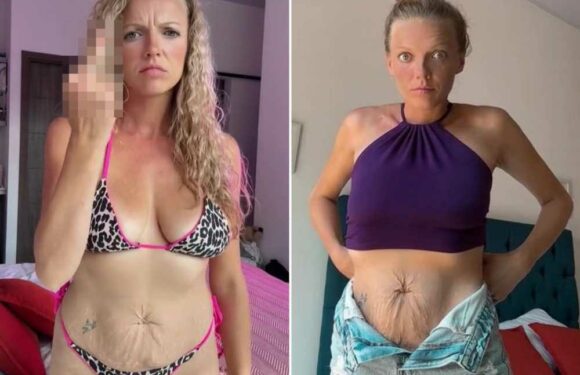 Trolls say my mum tum looks like a bum and tell me to cover up but I don't care, I won't stop wearing bikinis | The Sun