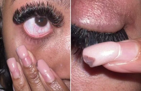 Beauty fan questions if she's had a reaction to her lash extensions, but people are more concerned about another issue | The Sun