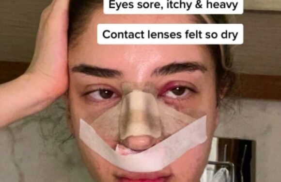 I jetted to Turkey for a nose job but it was utter hell – I couldn’t eat for days & trolls say I made a huge mistake | The Sun