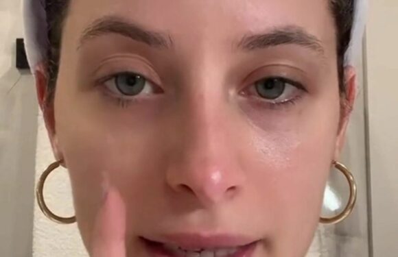 I’m a beauty whizz and found a 5p hack to banish dark undereye bags in just 15 minutes, you just need a kitchen staple | The Sun