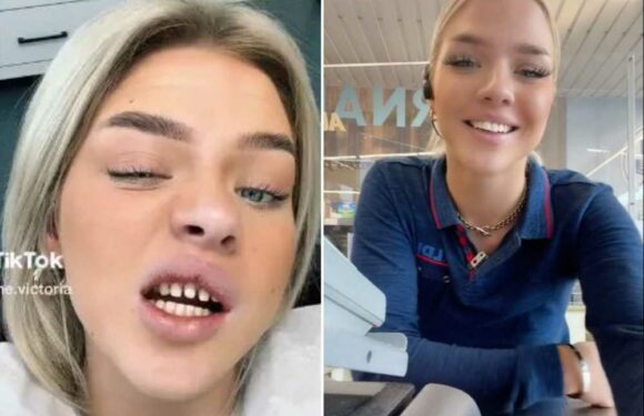 I'm the world's hottest Aldi worker & upgraded my look with Turkey teeth, but trolls call it the 'biggest fail ever' | The Sun