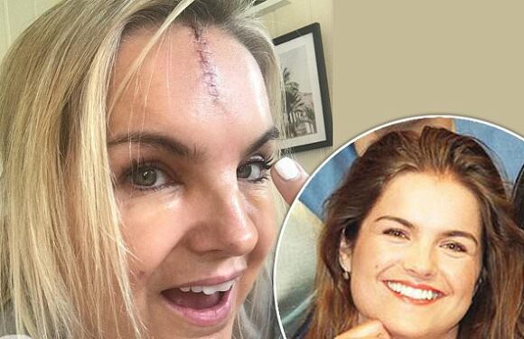 Katy Hill looks unrecognisable as she shares snaps of nasty face scar