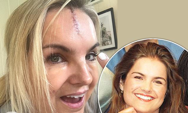 Katy Hill looks unrecognisable as she shares snaps of nasty face scar
