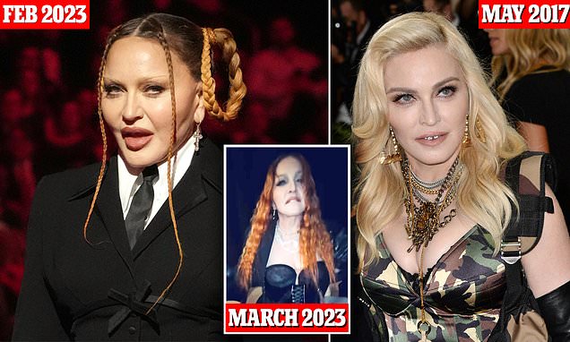 Madonna desperate to return to natural face for Celebration Tour
