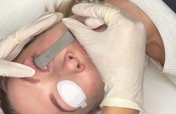 Beautician leaves people shell shocked as she shares the gruesome way eyeliner tattoos are lasered off | The Sun