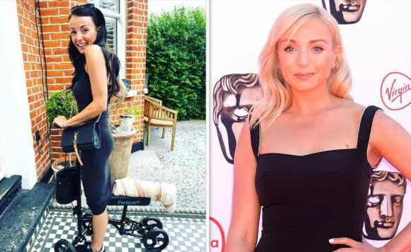 Call the Midwife’s Helen George sparks concern as she unveils painful injury