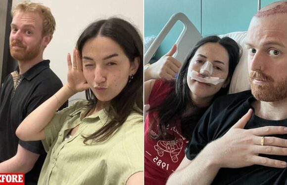 Couple 'bond' by getting cosmetic surgery together in Turkey
