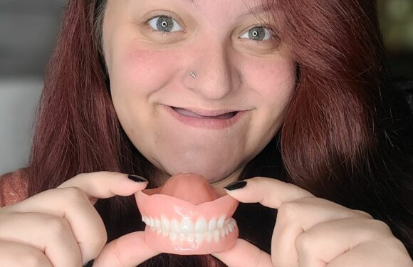 ‘I lost all my teeth but transform with dentures in – people call me a catfish’