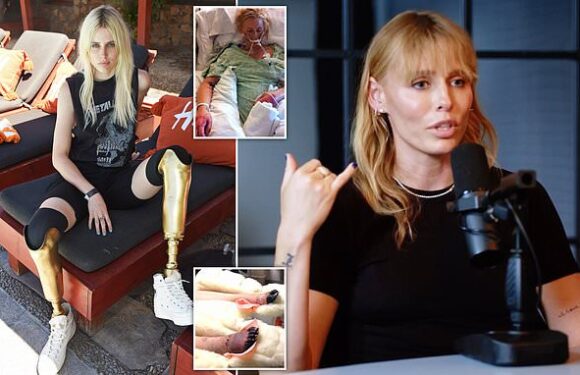 I was 10 minutes from death and lost both my legs because of a tampon