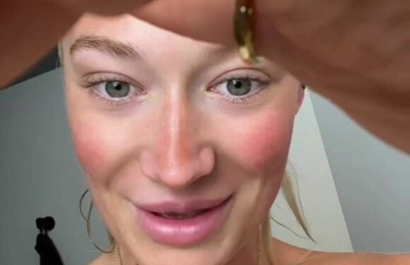 Woman shows the mortifying error she made with her fake tan and why you should NEVER do it with a hairband on | The Sun